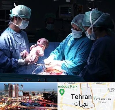 جراح سزارین در صادقیه تهران