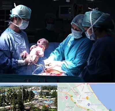 جراح سزارین در رودسر