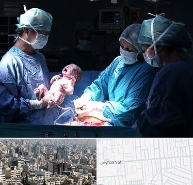 جراح سزارین در جیحون