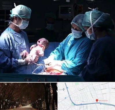 جراح سزارین در ابوریحان تبریز