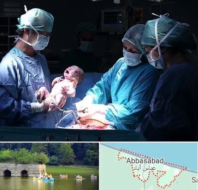 جراح سزارین در عباس آباد