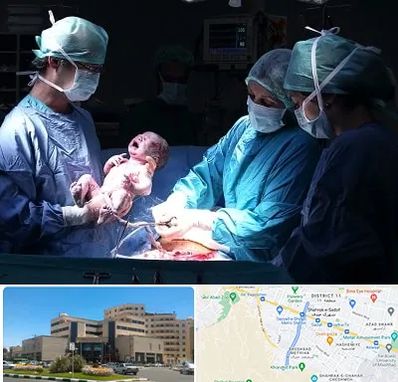 جراح سزارین در صیاد شیرازی مشهد