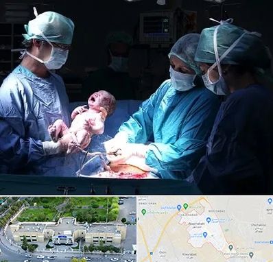 جراح سزارین در نسیم شهر