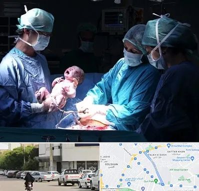 جراح سزارین در قدوسی شرقی شیراز