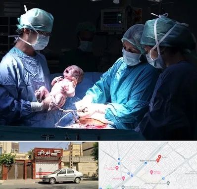 جراح سزارین در باجک قم
