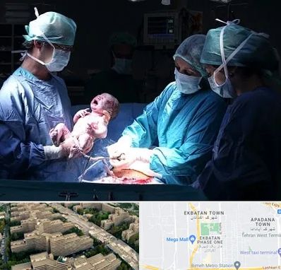 جراح سزارین در اکباتان