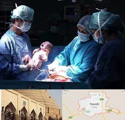 جراح سزارین در ساوه