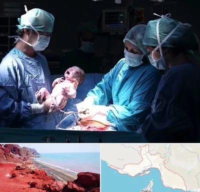 جراح سزارین در هرمزگان