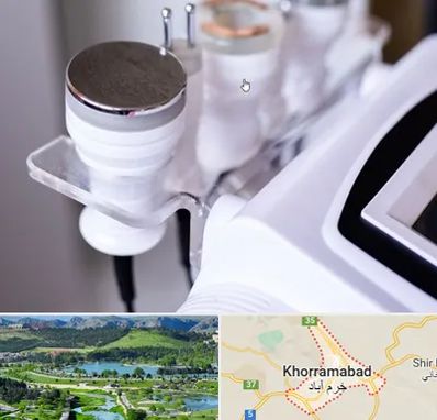 مرکز لاغری با کویتیشن در خرم آباد