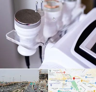 مرکز لاغری با کویتیشن در بلوار توس مشهد 