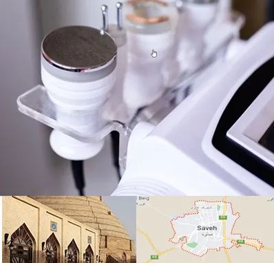 مرکز لاغری با کویتیشن در ساوه