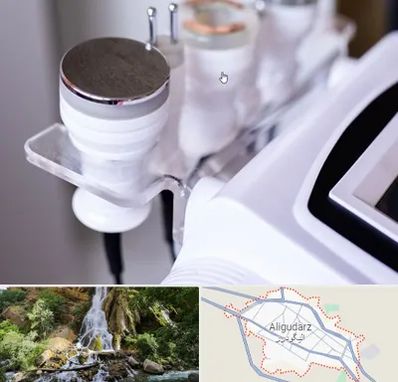 مرکز لاغری با کویتیشن در الیگودرز