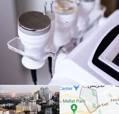 مرکز لاغری با کویتیشن در الهیه 