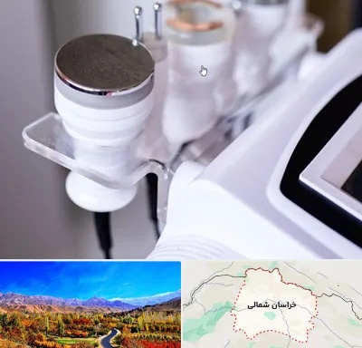 مرکز لاغری با کویتیشن در خراسان شمالی
