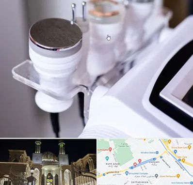 مرکز لاغری با کویتیشن در زرگری شیراز 