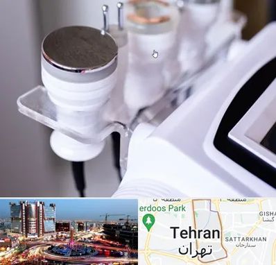 مرکز لاغری با کویتیشن در صادقیه 