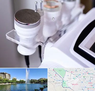 مرکز لاغری با کویتیشن در کوهسنگی مشهد 