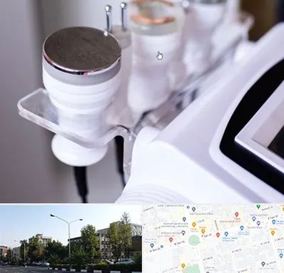 مرکز لاغری با کویتیشن در میدان کاج 