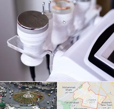 مرکز لاغری با کویتیشن در فردیس کرج 