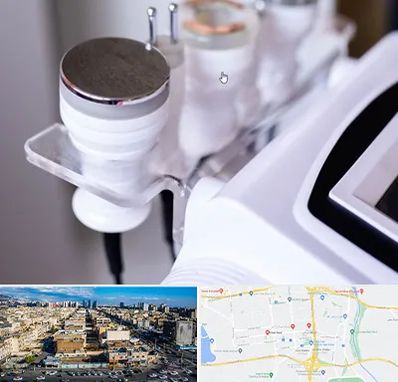 مرکز لاغری با کویتیشن در شهرک راه آهن 