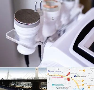 مرکز لاغری با کویتیشن در پارک وی 