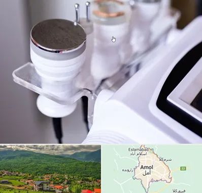 مرکز لاغری با کویتیشن در آمل