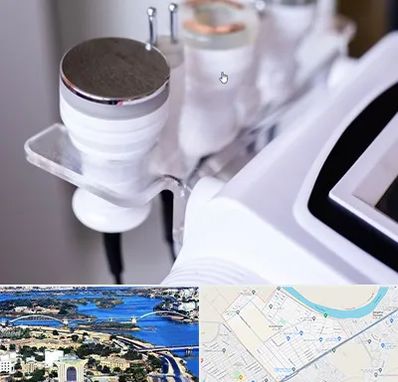 مرکز لاغری با کویتیشن در کوروش اهواز 