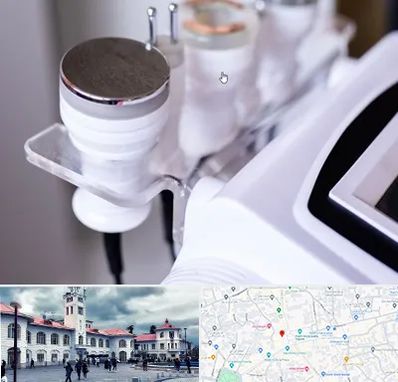 مرکز لاغری با کویتیشن در میدان شهرداری رشت 