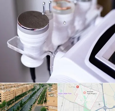 مرکز لاغری با کویتیشن در فاز سه اندیشه