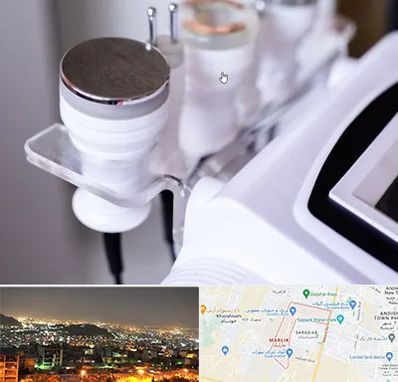 مرکز لاغری با کویتیشن در مارلیک کرج 