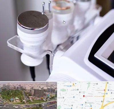 مرکز لاغری با کویتیشن در آیت الله کاشانی