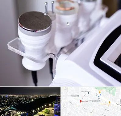 مرکز لاغری با کویتیشن در هفت تیر مشهد 