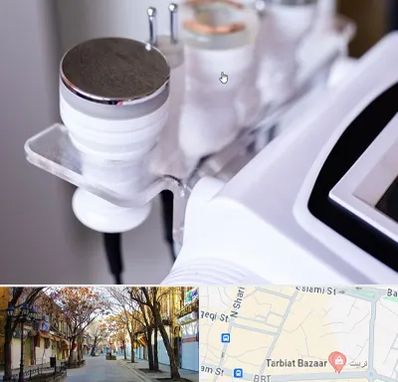 مرکز لاغری با کویتیشن در تربیت تبریز