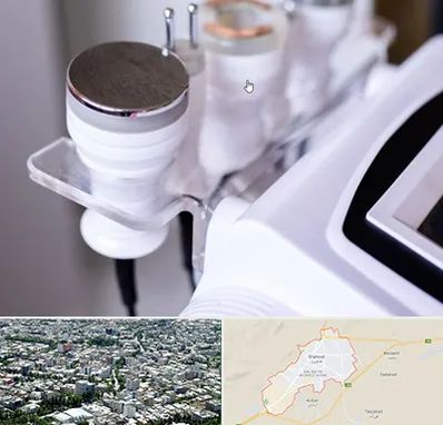 مرکز لاغری با کویتیشن در شاهرود