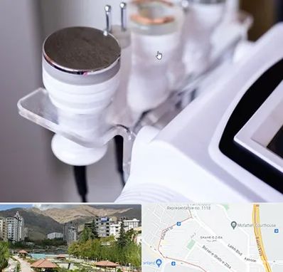 مرکز لاغری با کویتیشن در شهر زیبا 