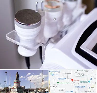 مرکز لاغری با کویتیشن در کارگر جنوبی 