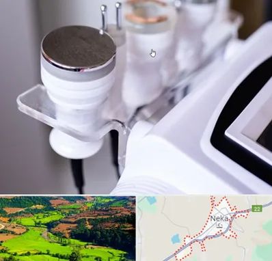 مرکز لاغری با کویتیشن در نکا