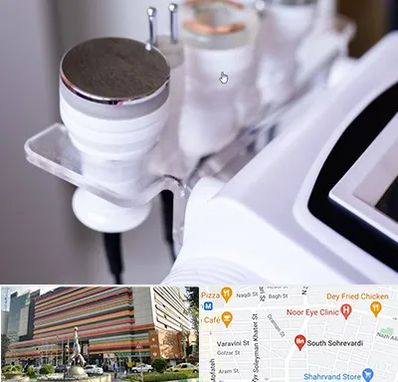 مرکز لاغری با کویتیشن در سهروردی 