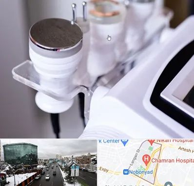 مرکز لاغری با کویتیشن در اقدسیه 