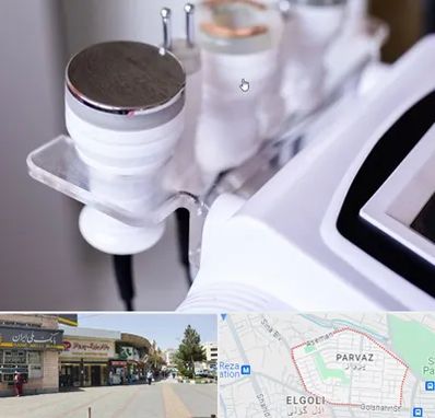 مرکز لاغری با کویتیشن در پرواز تبریز