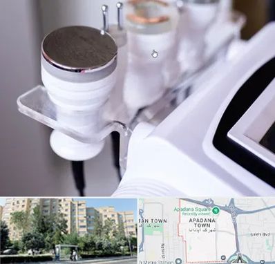 مرکز لاغری با کویتیشن در آپادانا