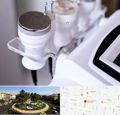 مرکز لاغری با کویتیشن در هفت حوض 