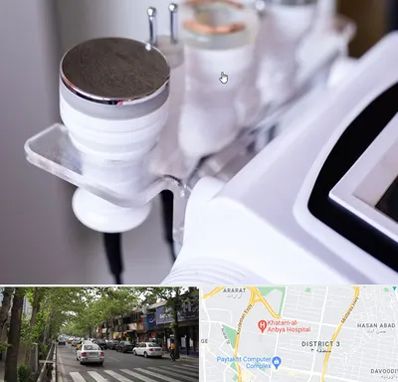 مرکز لاغری با کویتیشن در ظفر 