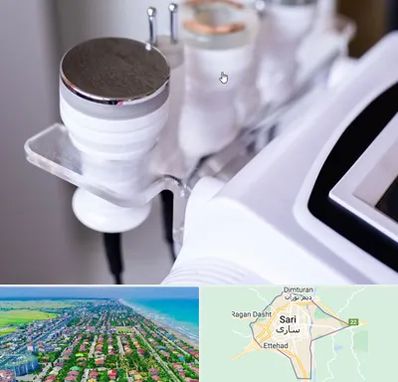 مرکز لاغری با کویتیشن در ساری