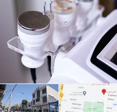 مرکز لاغری با کویتیشن در افسریه 