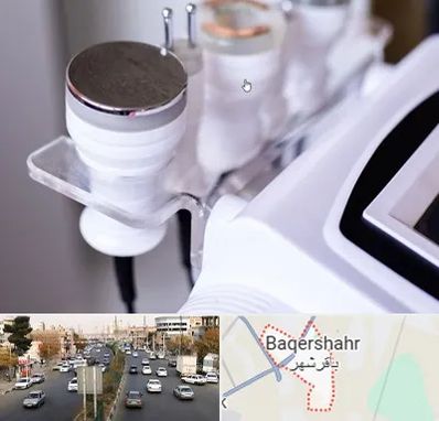 مرکز لاغری با کویتیشن در باقرشهر