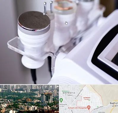 مرکز لاغری با کویتیشن در عظیمیه کرج 