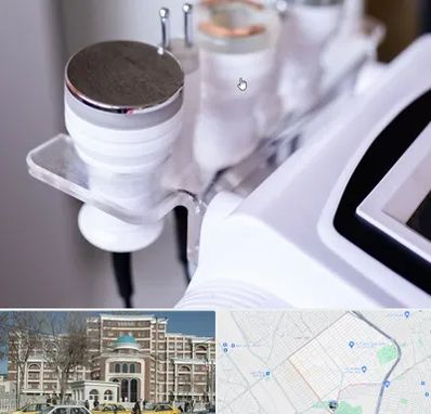 مرکز لاغری با کویتیشن در طلاب مشهد