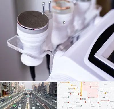 مرکز لاغری با کویتیشن در توحید 