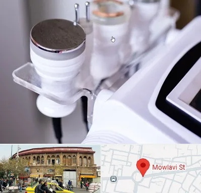 مرکز لاغری با کویتیشن در مولوی